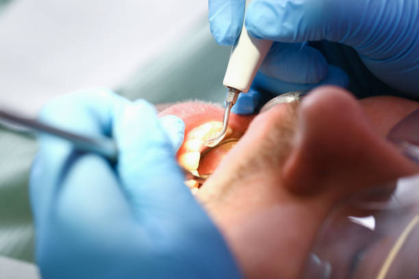 Best Pediatric Emergency Dentist in Ocean Grove, MA