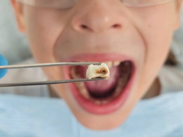 Best Broken or Cracked Tooth Emergency Dentist in Ocean Grove, MA